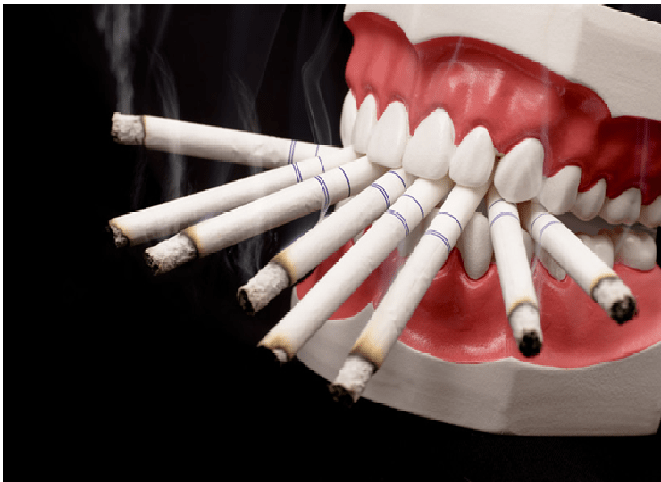 Effects of Tobacco on Mouth, Gums and Oral Health
